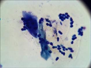 aspect citologic malassezia pachydermatis (2)
