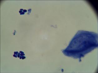 aspect citologic malassezia pachydermatis (3)